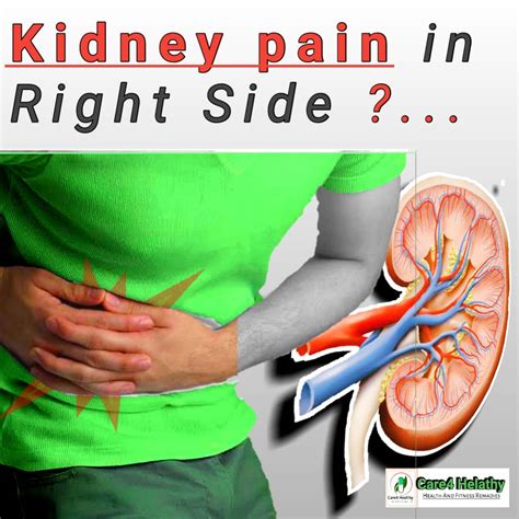 Right Kidney Pain Location
