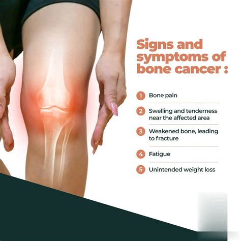 Gallery | Images & Videos | Dr Ch Mohana Vamsy | Oncology