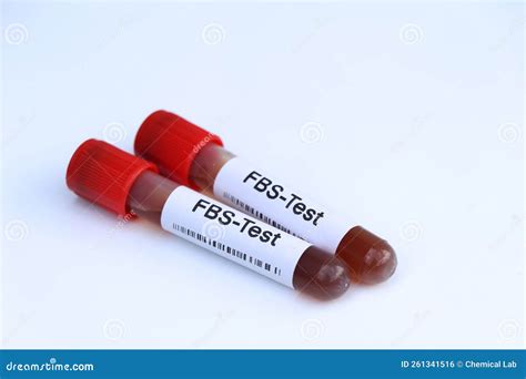 FBS Test To Look for Abnormalities from Blood Stock Photo - Image of exam, diabetes: 261341516