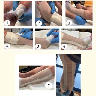 Image result for Applying a Compression Bandage