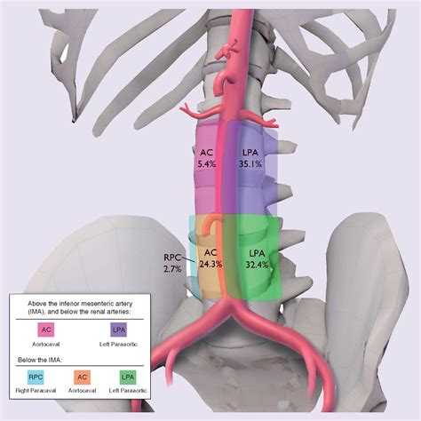 Para Aortic Nodes
