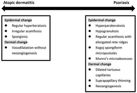 Overlapping Features of Psoriasis and Atopic Dermatitis: From Genetics ...