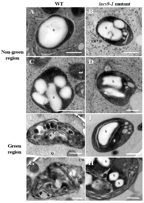 Functional Analysis of Rice Long-Chain Acyl-CoA Synthetase 9 (OsLACS9 ...