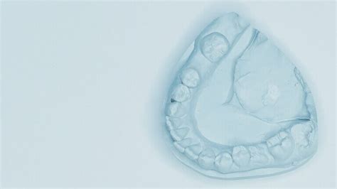 Dentitio difficile: Ursachen, Symptome und konservative ...