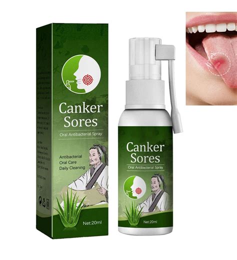 Oral Ulcer Relief Spray 20ml - Canker Sore & Gum Pain Relief Treatment | Buy Now with Express ...