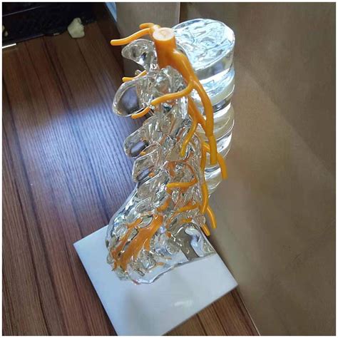 Fga Educational Model Lumbar Spine Model Medical Anatomical Vertebrae ...