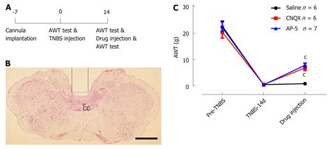Nucleus tractus solitarius mediates hyperalgesia induced by chronic pancreatitis in rats