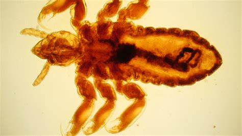 Body Louse - Explore Microscopy