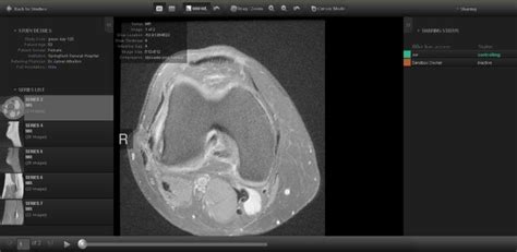 Web Application Programming Interface 的图像结果