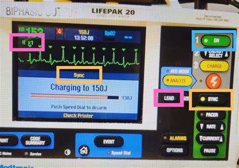 Image result for Synchronized Cardioversion Life Pak 15 Sync Button