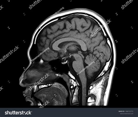 144 Midbrain Stock Photos, Images & Photography | Shutterstock