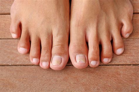 Image result for How File Thick Toenails