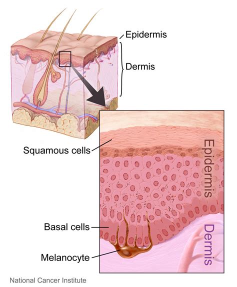 Squamous And Basal Cell
