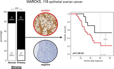 Stromal Expression of MARCKS Protein in Ovarian Carcinomas Has ...