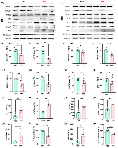 Alpha-Synuclein Preformed Fibrils Induce Cellular Senescence in ...