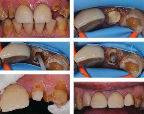 Image result for Operative Dentistry