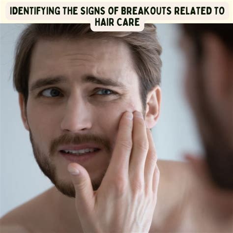 Are Your Hair Products Causing Breakouts? Expert Tips | Clinikally