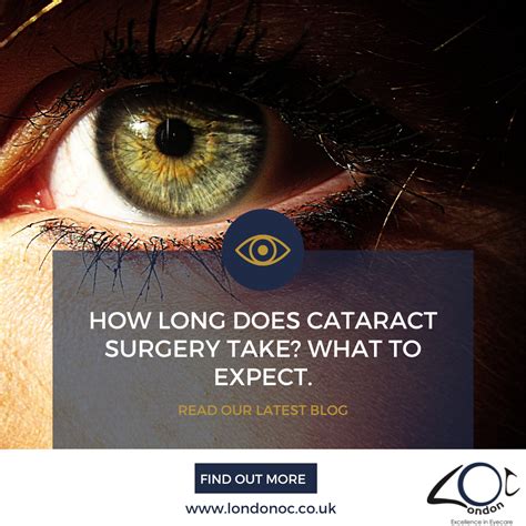 How long does cataract surgery take? What to expect - LondonOC