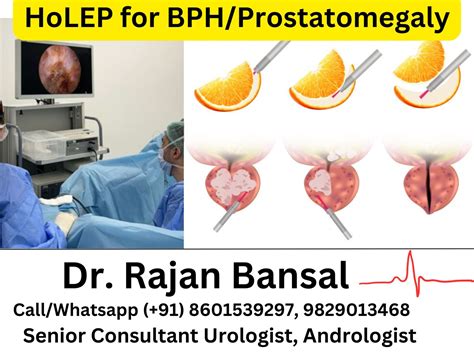 Use of Holmium Laser Enucleation (HoLEP) for Benign Prostatic Hyperplasia (BPH)