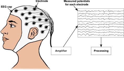 Electroencephalography (EEG) in Chhindwara | Dr. Lalit Mahajan