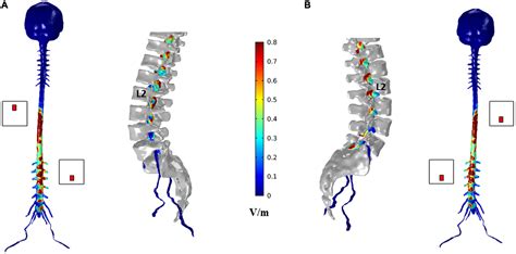 Frontiers | Lumbar trans-spinal direct current stimulation: A modeling ...