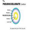 What is coelom? Explain the different types of coelom with suitable ...