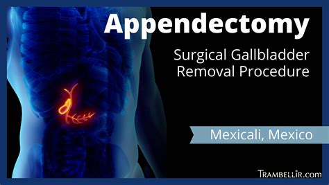 Appendix Removal Surgery 的图像结果