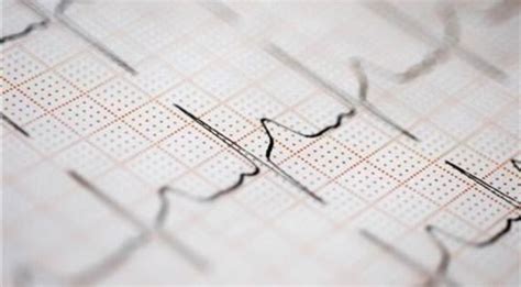 AI Can Detect Heart Failure With 100% Accuracy By Hearing Just A Single ...