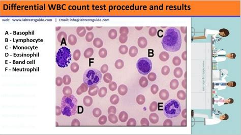 Image result for WBC Count Microscope