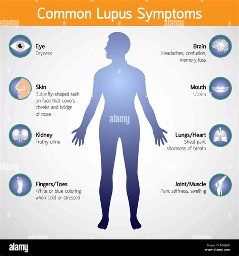 common lupus symptoms vector logo icon illustration Stock Vector Image & Art - Alamy