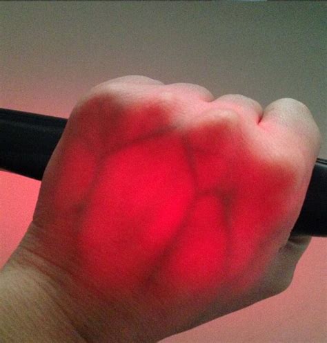 Transilluminator / vein finder /vein viewer /vein ... – Grandado