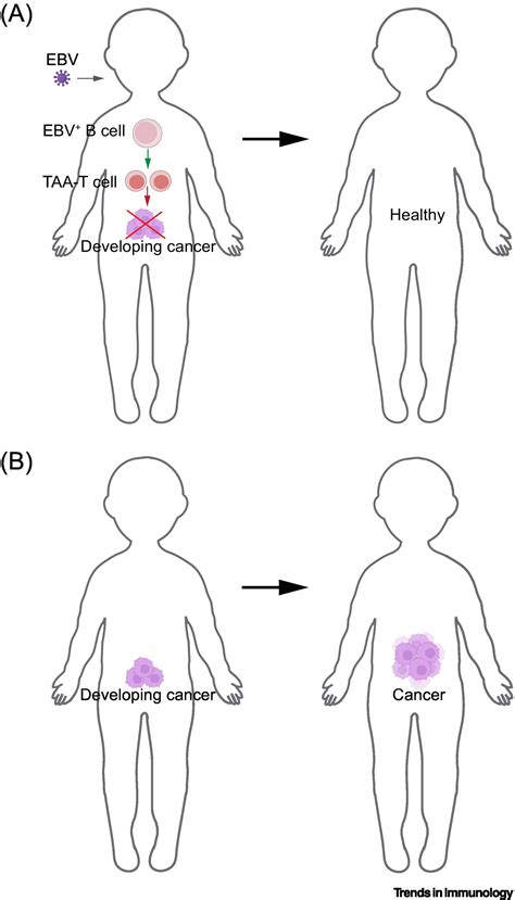 Does delayed EBV infection contribute to rising childhood cancers ...