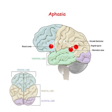 Image result for Broca's area Function