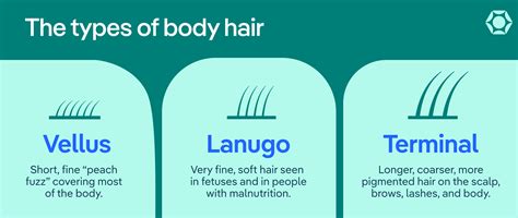 Lanugo and Anorexia: What Fine Hair Growth Means for Health