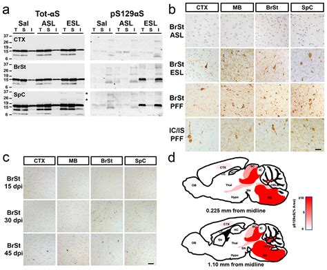 Soluble and Insoluble Lysates from the Human A53T Mutant α-Synuclein ...