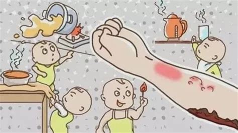 小儿推拿杨晓：宝宝烫伤的原因有哪些？如何预防及处理儿童烫伤？|烫伤|烧烫伤|杨晓_新浪新闻