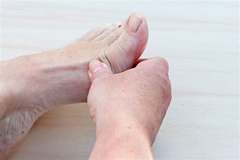 Ganglion Cysts - Foot & Ankle Institute of the West