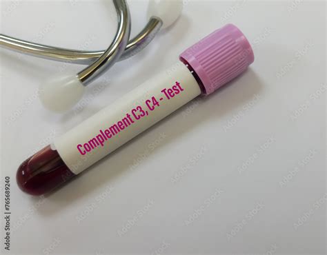 Image result for C4 Complement Blood Test