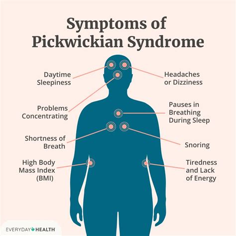 Pickwickian Syndrome: Symptoms, Causes, Diagnosis, Treatment, and Prognosis