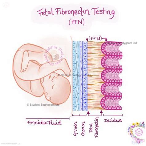 Image result for Fetal Fibronectin Log Form