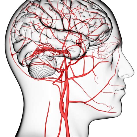 Conozcan que es un ataque o derrame cerebral - DIARIO ROATÁN
