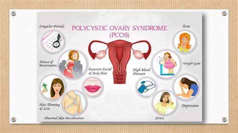 PCOS/PCOD (polycystic ovarian syndrome/polycystic ovary disease) | PPTX