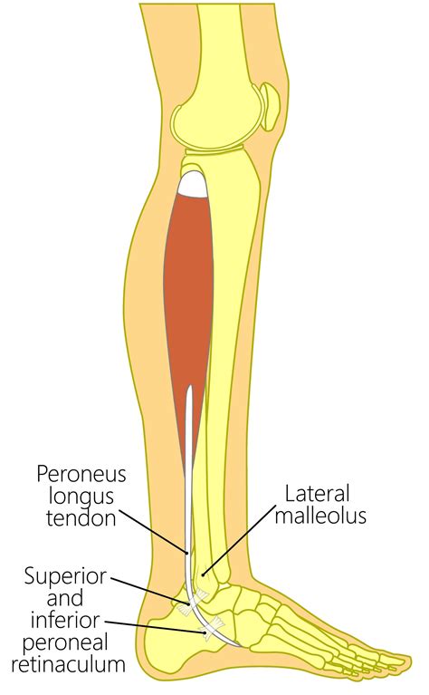 Ankle Tendonitis Treatment: *Causes, Symptoms & Treatment*