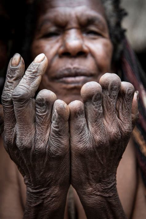 揭秘印尼食人族部落：用烟熏方式保存祖先尸体，亲人去世女人断指_腾讯新闻