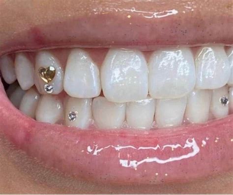Image result for DIY Tooth Gems