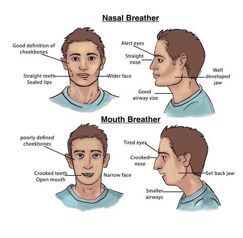 Mouth Breather Vs Nose Breather Face at Sue Alexander blog