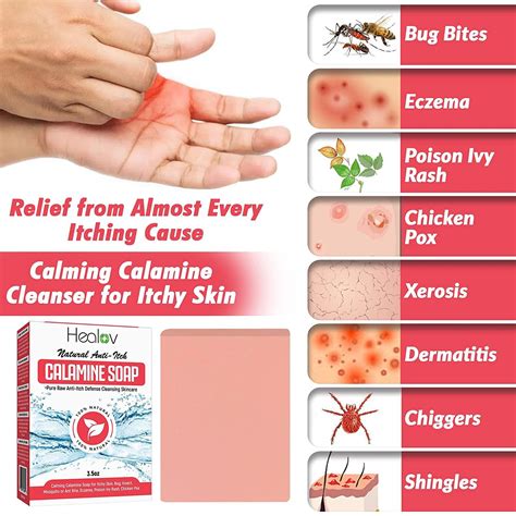 Calamine Instant Itch Relief Soap Bar - Natural Anti-Itch Defense Cleanser for Bug Bites, Eczema ...