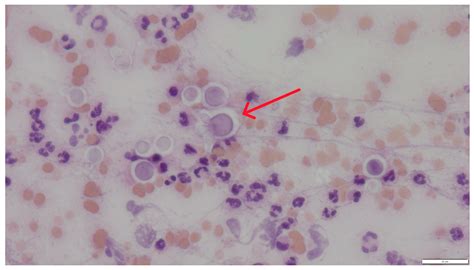 Feline Cryptococcosis: Two Case Reports and a Literature Review