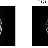 Image result for Robert Edge Detection Program