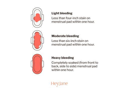 How Long After Pill Abortion Do You Bleed | Detroit Chinatown